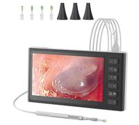 XINGLUOY Digital Otoscope with 7 Inch IPS Screen, 3.9mm Ear Wax Removal Tool Camera with 6 LED Lights, Visual Ear Camera and Wax Remover, Supports Photo Snap and Video Recording