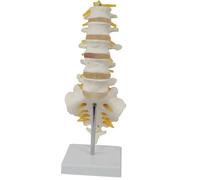 Xinzhai Lumbar Spine Anatomy Model With Sacrum And Spinal Nerves, Didactic Replica Of Lumbosacral Section With Nerves And A Herniated Disc, Includes Base For Medical Teaching Display