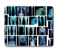 XRay Bone Fracture Plate Pins Mouse Mat Pad Computer PC Laptop Gaming Office Home Desk Accessory Gadget 21685