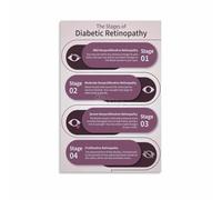 XTVVTODJXT Diabetic Retinopathy Guide Poster Eye Complications from Diabetes Symptoms Prevention Info Educational Chart for Doctor Office Clinic Classroom(Unframed,08x12inch(20x30cm))