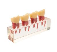 YARNOW Teaching Model for Pediatric Oral Pathology with Interactive Removable Teeth and Resin Material, for Clinical Demonstration and Hands-on Practice in Patient Education