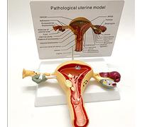 YHNNH, Medical Anatomical Human Uterus Model, Uterus Ovary Anatomical Model with Pathologies, Advanced Simulation Maternal Uterus Structure Model
