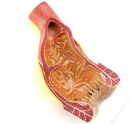 YHNNH, Medical Anatomical Rectum Organ Model, PVC Material, Anorectal Surgery General Surgery Specialist Training Teaching