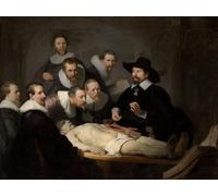 YIMACBJXX Famous Painting Poster Artworks Posters And Prints The anatomy lesson of dr. nicolaes Tulp by Rembrandt van Rijn Canvas Artwork Print for Home Decor 60x90cm