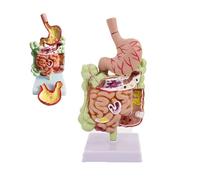 YNIYUJKL Large Intestine Pathology Model, Gastrointestinal Anatomy Model With Common Lesions, Educational Digestive System Model For Human Anatomy Studies