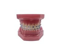 YOUYA Dental TM-208 Demonstration Orthodontic Model Teeth Teach Study Tools with Metal and Ceramic Bracket(Red)