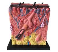 YTUK Skin Acne Model,Human Skin Anatomy Model, 80X Acne Epidermis Anatomy Dermis Skin Fat Anatomy Suitable For Doctor's Office, Medical Learning Resources