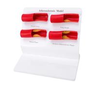 Yusat Atherosclerosis Model Anatomical Artery Display Demonstrates Plaque Buildup Lumen Stenosis with Smooth Surfaces for Classroom Laboratories Clinics