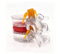 YXHXWKJ Human Anatomical Lumbar Disc Herniation Model-1.5 Times Life Size Lumbar Disc Teaching Model Tool For Medical &Teaching & Learning And Scientific Presentations(Transparent)