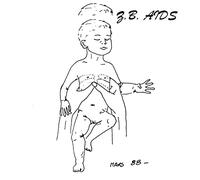 Z.B. Aids - Gestalt [VINYL]