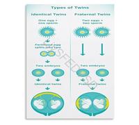 ZDVHOMCB Twin Babies Placentation Diagram Educational Poster Information Wall-Art Canvas Print for Hospital and Home Decor Unframed,16x24inch(40x60cm)