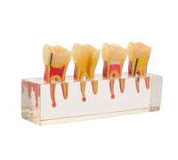 Zerodeko Dental Teeth Model Kit with Pulp Repair Structure Comprehensive Pathological Teeth for Dental School Teaching Realistic Deciduous Lesion Demo Oral Health Consultation Model