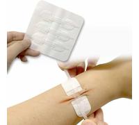 Zip Stitch Wound Closure Device, Non-Invasive Adjustable Skin Tension Reducer, Emergency Sterile Wound Closure Bandage for Laceration Repair（10 Pack）