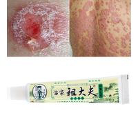 ZUDAIFU 15g Chinese Medicine Cream Antibacterial Eczema